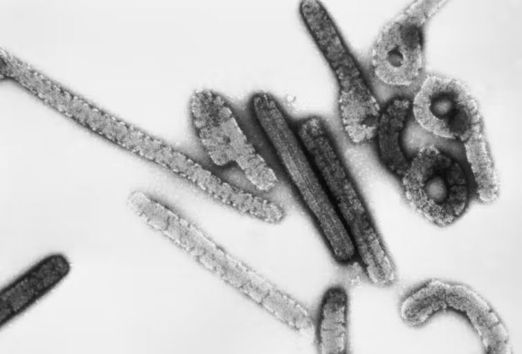 ¿Qué es la enfermedad del virus de Marburgo, cuyos síntomas son similares al ébola?
