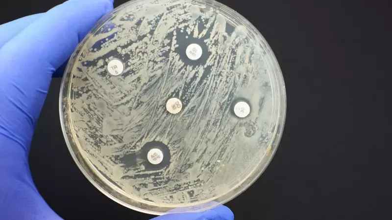 “Pandemia silenciosa”: las infecciones por bacterias resistentes a antibióticos matan más personas que la malaria y el sida