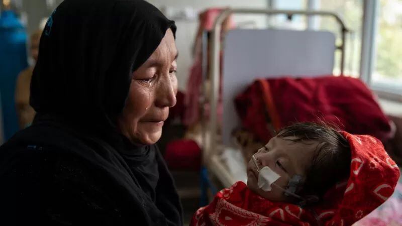 Millones de niños afganos están padeciendo desnutrición. GETTY IMAGES