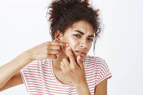 ¿Comer ajo crudo puede curar el acné? Expertos opinan sobre la tendencia viral en TikTok
