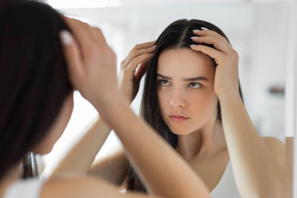 La genética, el estrés y la falta de higiene capilar son posibles razones detrás de la caída del pelo
