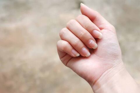 El significado oculto de las estrías en tus uñas: Más que una cuestión estética es un problema de salud