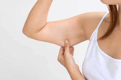 Eliminar la flacidez de los brazos en mujeres mayores de 40 años es sencillo con estos 4 ejercicios